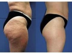 Extension ciglia