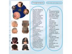 Dermopigmentazione / Tricopigmentazione / Areola