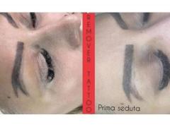 Dermopigmentazione / Tricopigmentazione / Areola